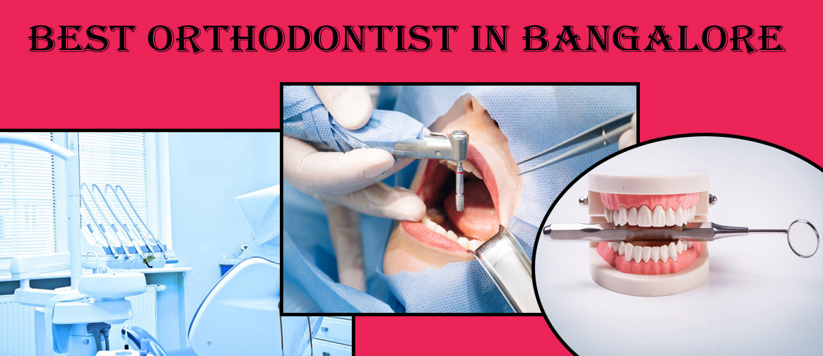 Good Dental Hospital in BangaloreBest Orthodontist in Bangalore