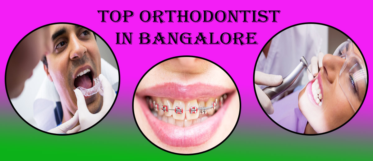 Top Orthodontist in Bangalore 