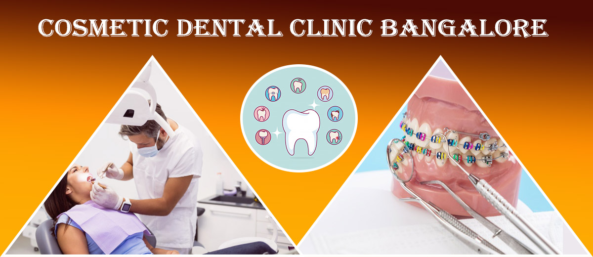 Cosmetic Dental Clinic Bangalore 