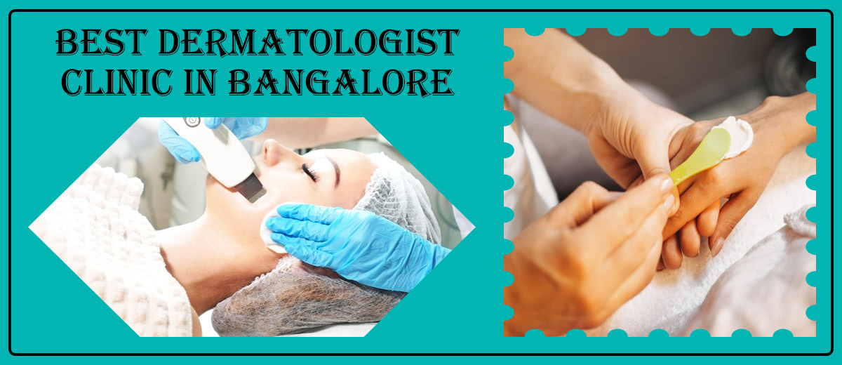 Best Dermatologist Clinic In Bangalore | Famous Skin Clinic