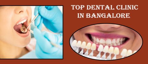 Best Dental Clinic In Bangalore | Dental Clinic In Bangalore