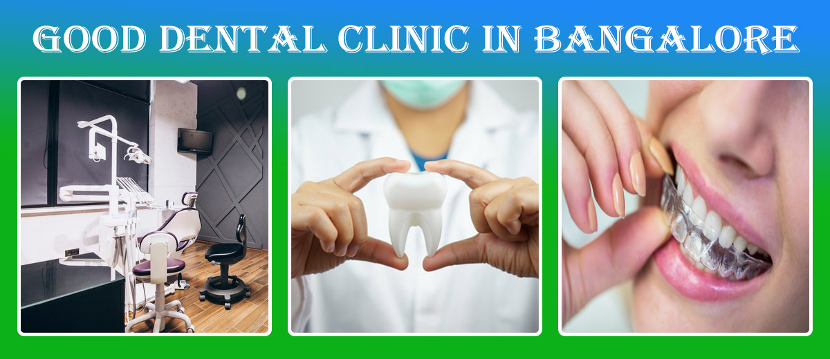 Best Dental Clinic In Bangalore | Dental Clinic In Bangalore