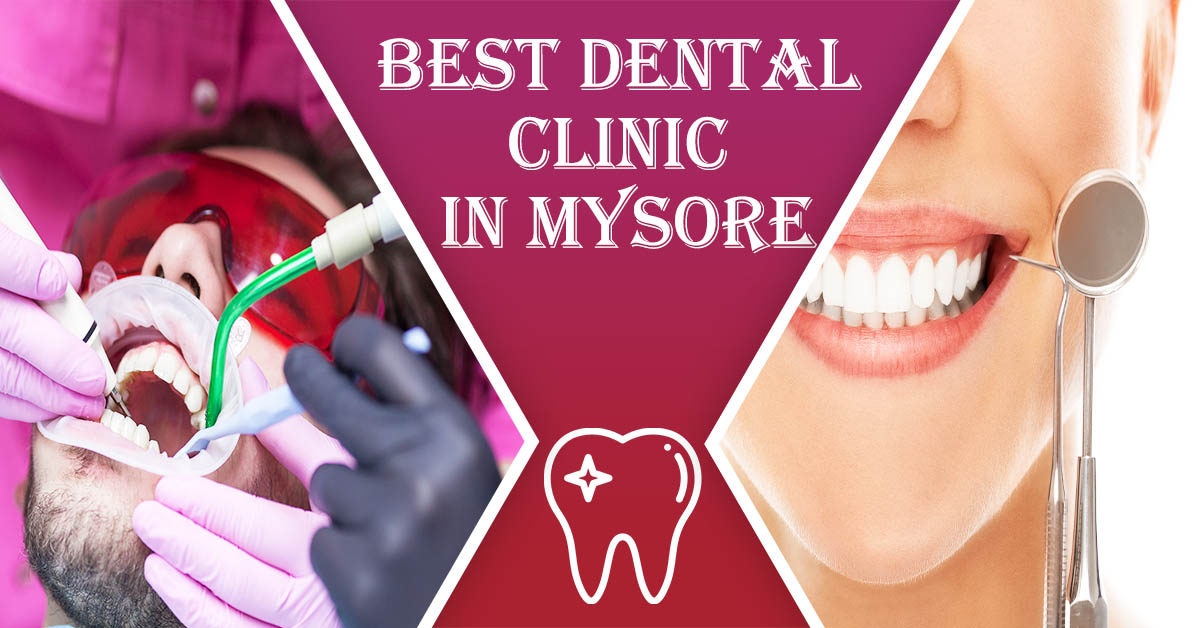 Best Dental Clinic in Mysore