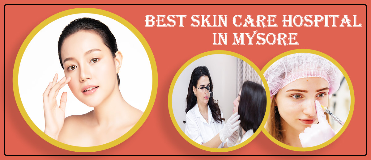 Best Skin Care Hospital in Mysore