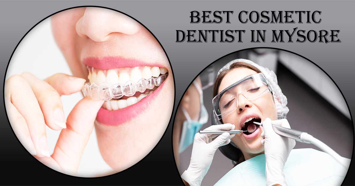 Best-Cosmetic-Dentist-in-Mysore