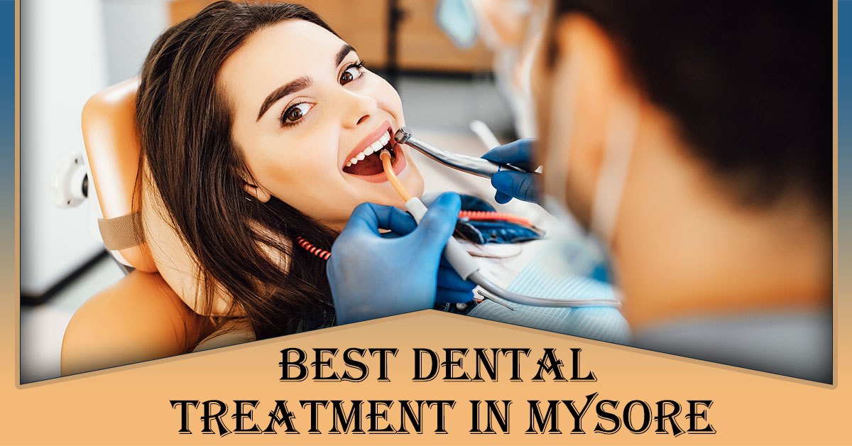 Best-Dental-Treatment-in-Mysore