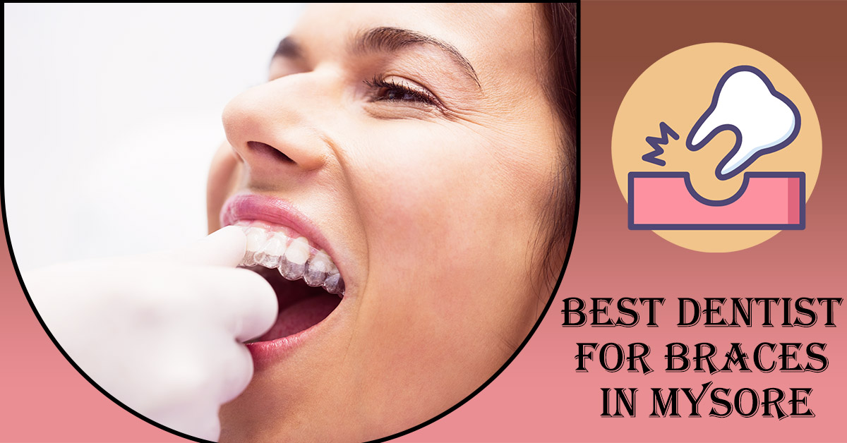 Best-Dentist-for-Braces-in-Mysore