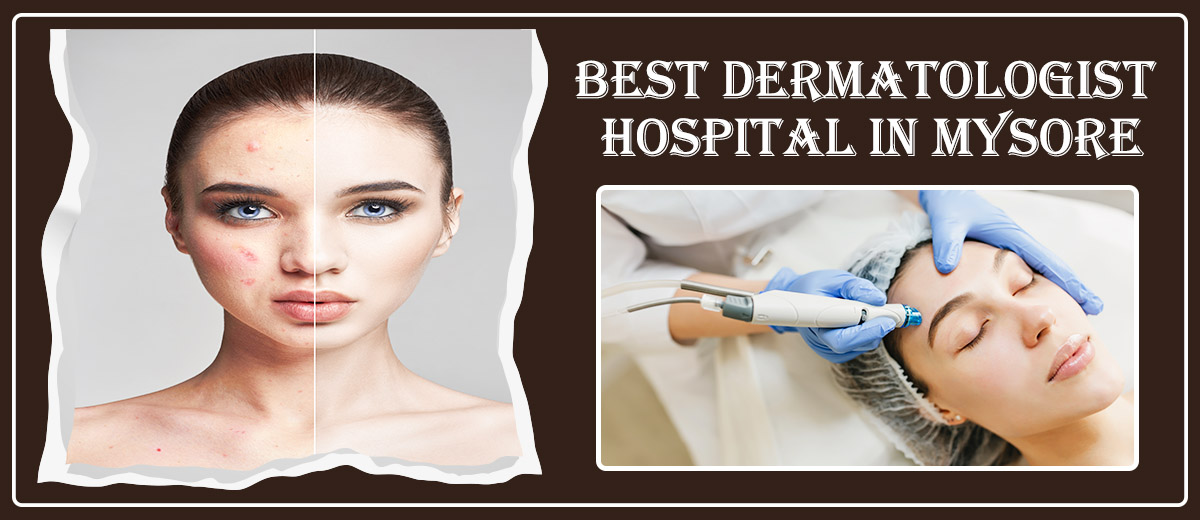 Best-Dermatologist-Hospital-in-Mysore