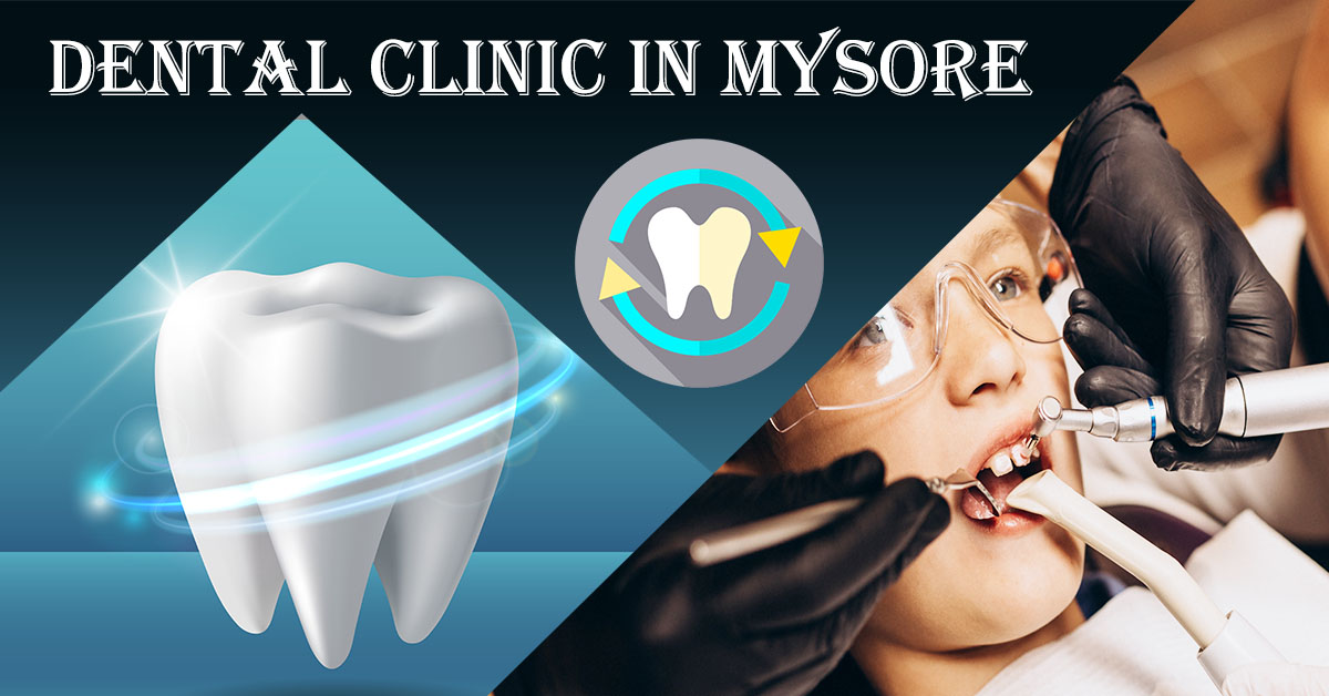 Dental-Clinic-in-Mysore