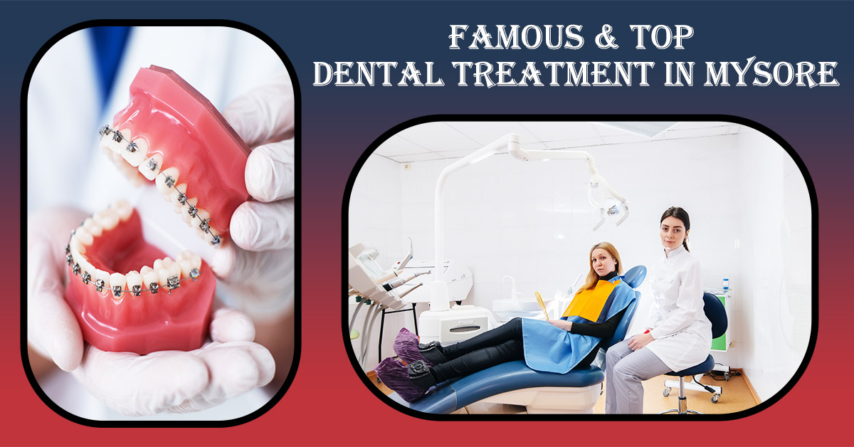 Famous-Top-Dental-Treatment-in-Mysore