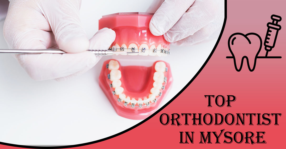 Top-Orthodontist-in-Mysore