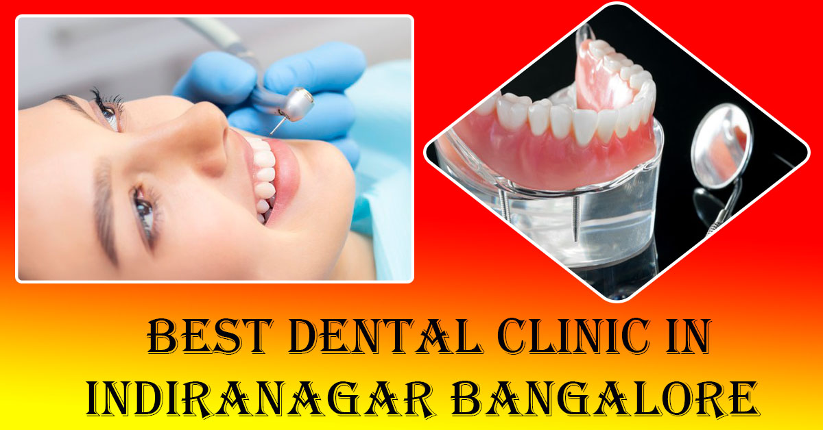 Best Dental Clinic in Indiranagar Bangalore 